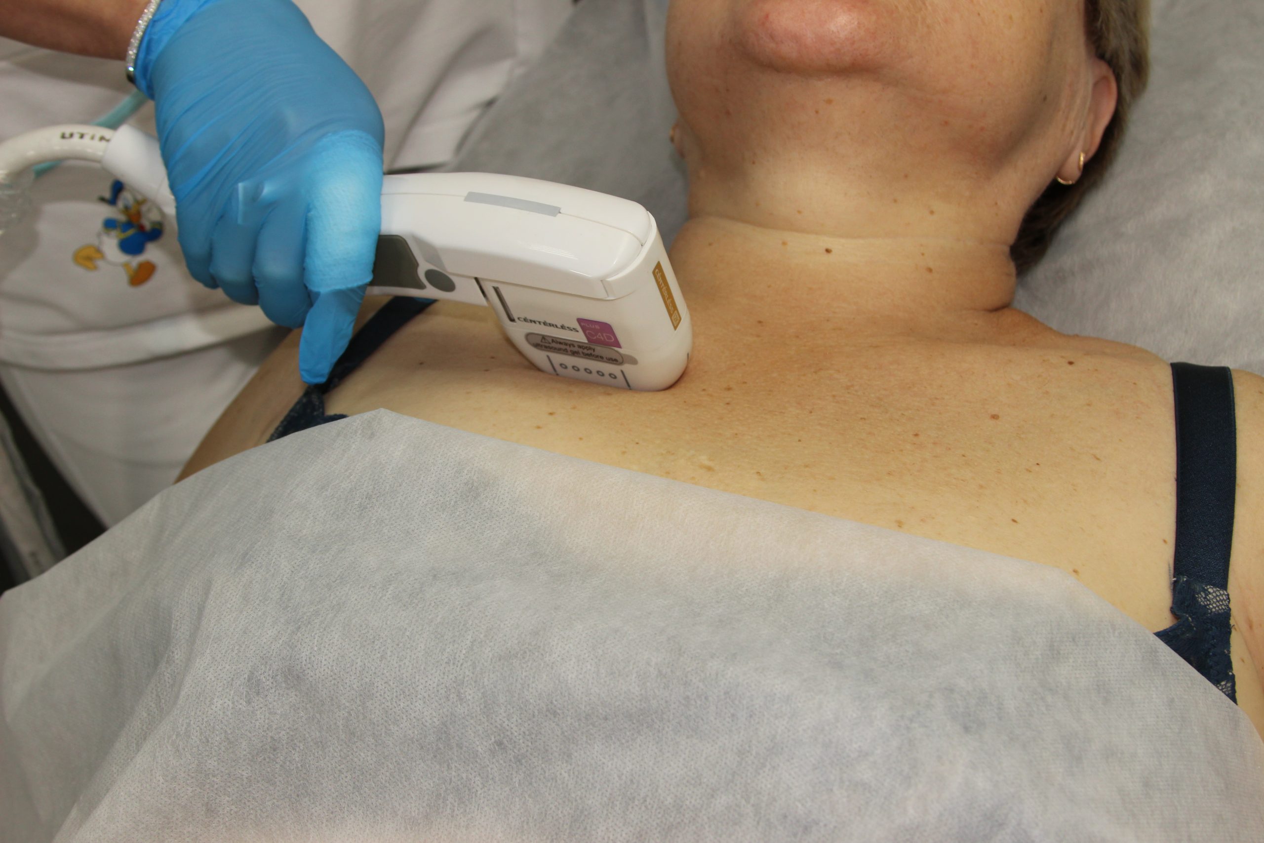 Показания к SMAS-лифтингу груди