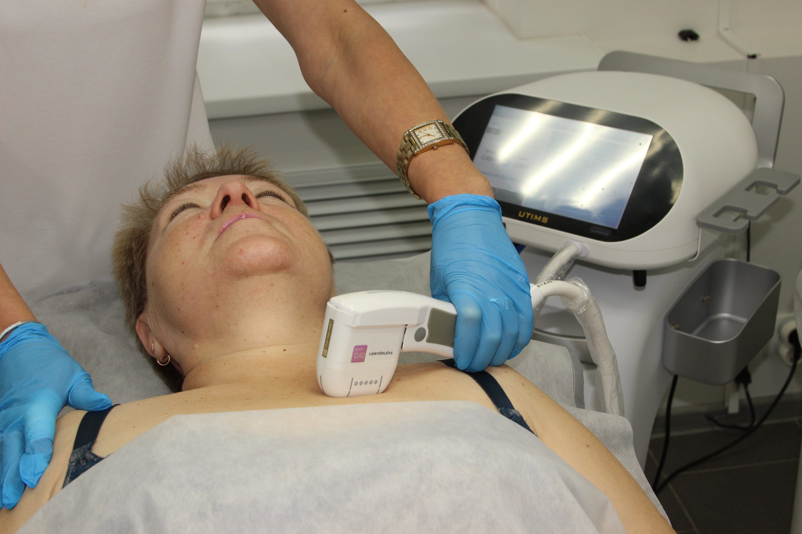 Эффект от SMAS-лифтинга груди