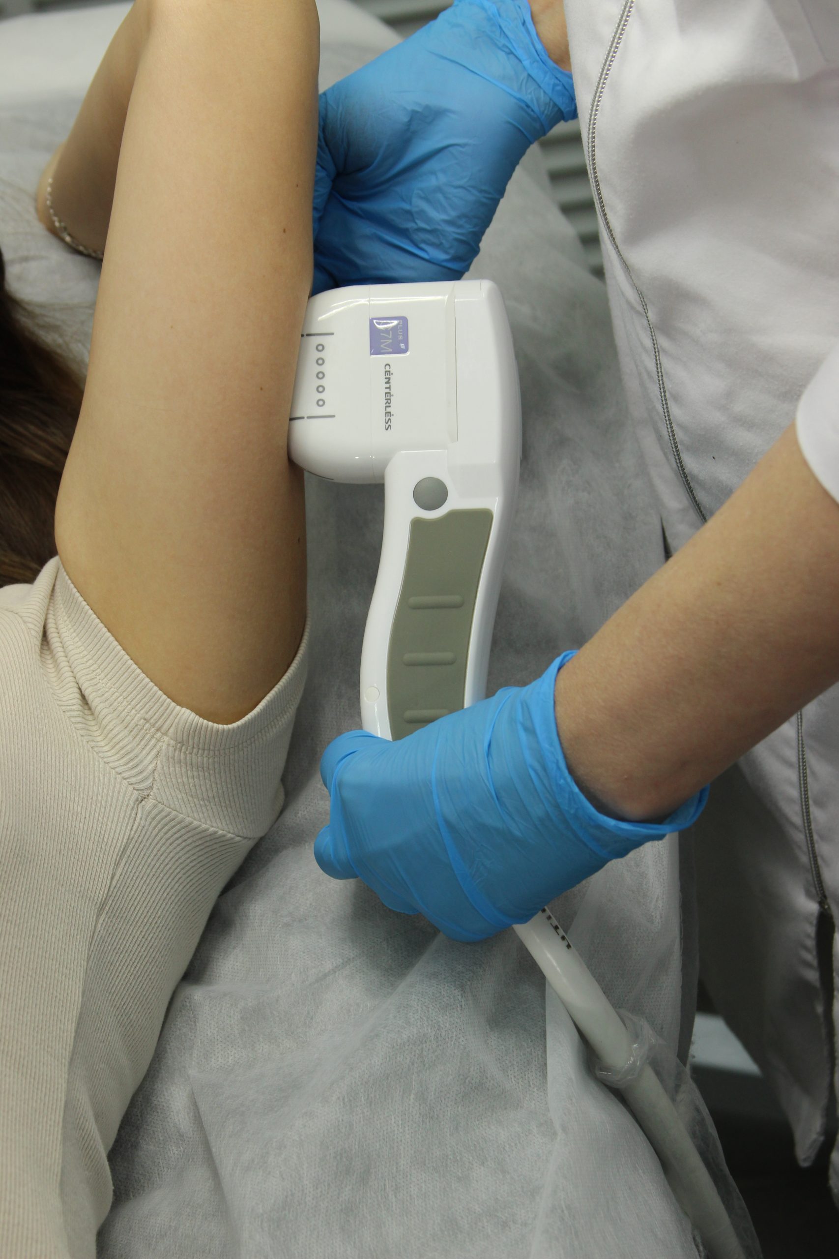 SMAS-лифтинг рук