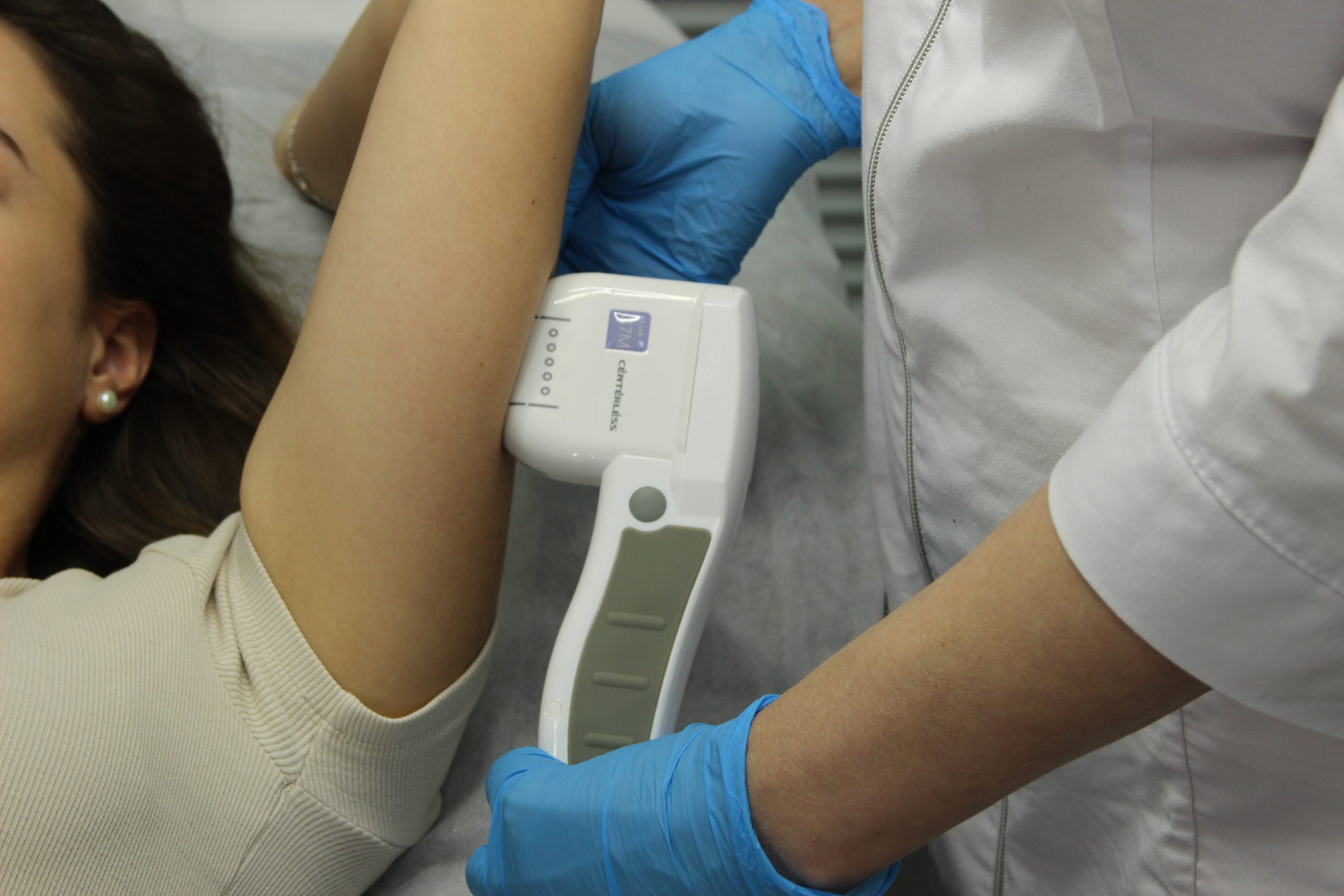 SMAS-лифтинг рук в клинике Бегмы