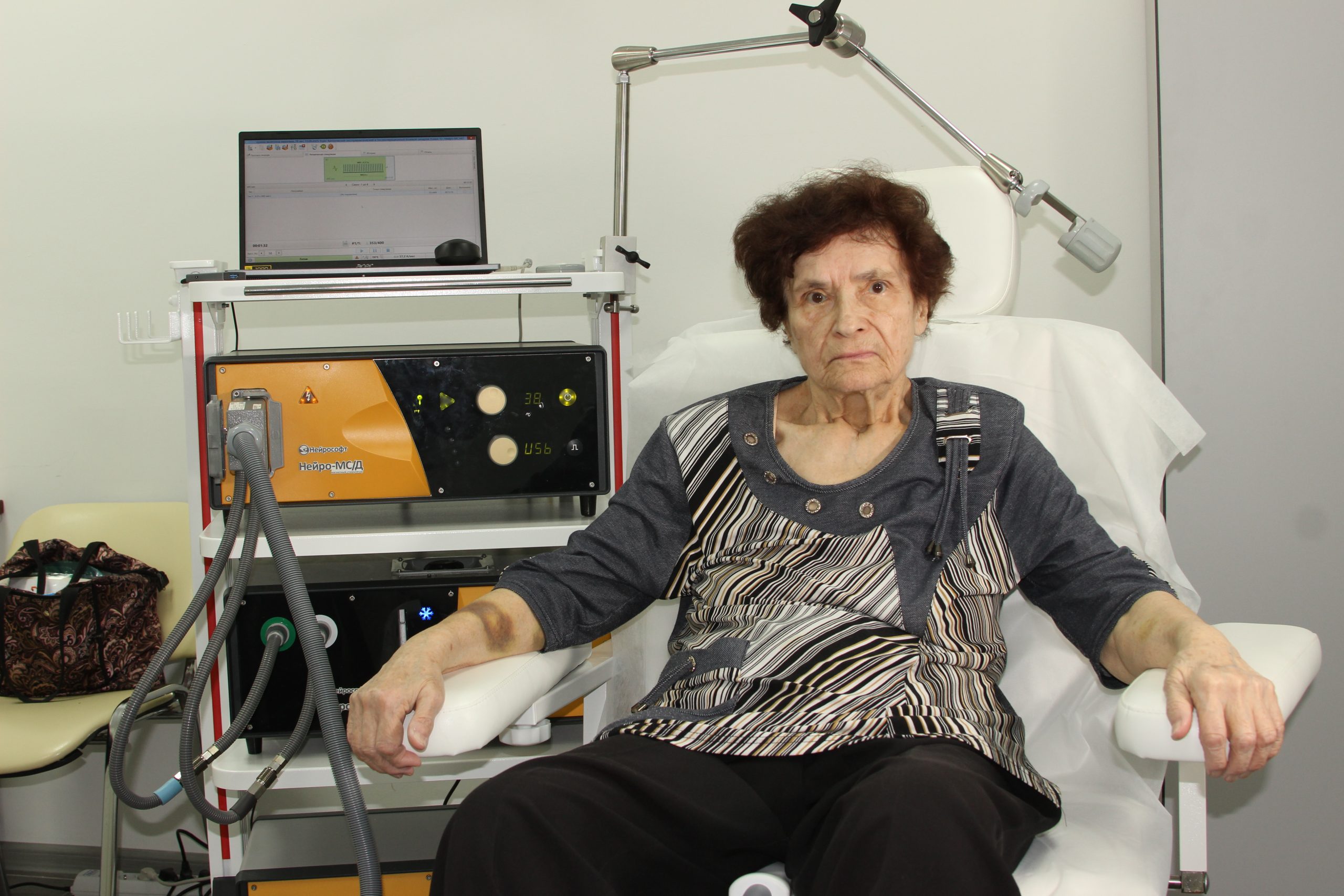 ТМС при депрессии