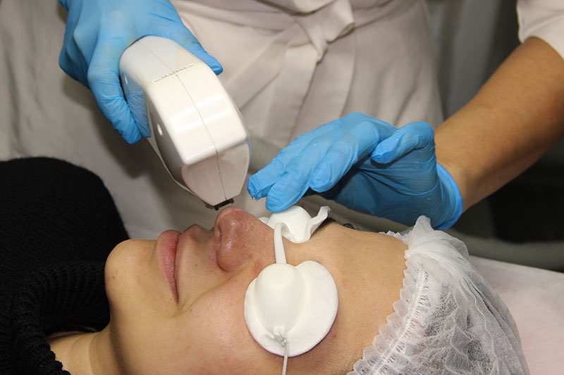 Противопоказания