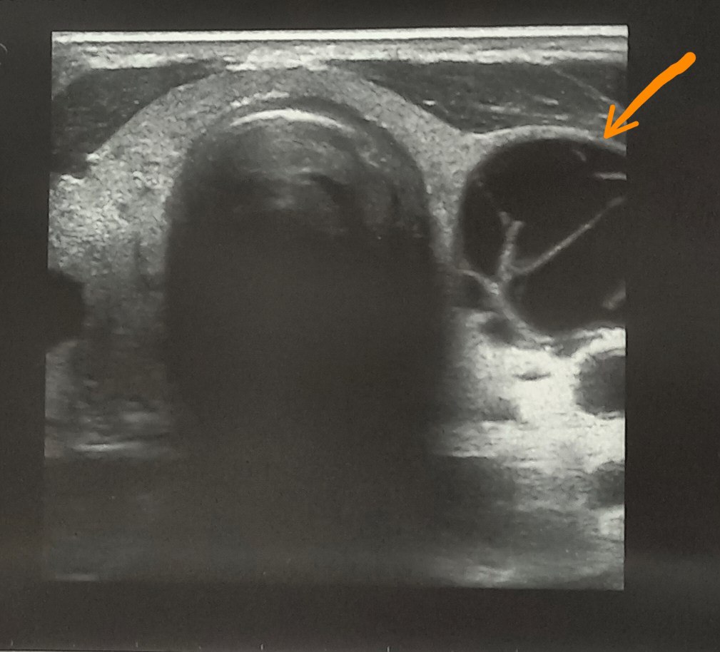 Подготовка к операции