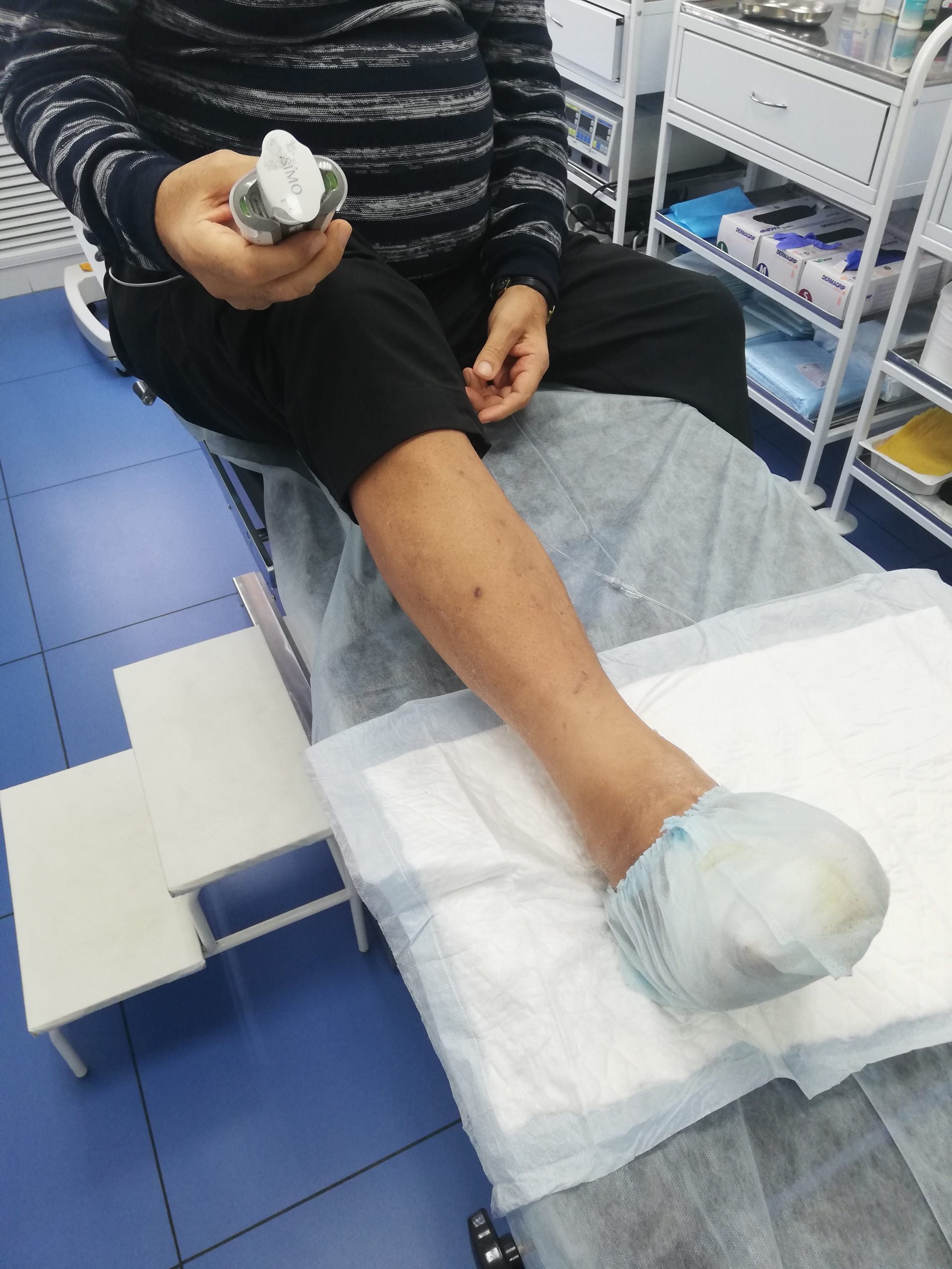 Как проводится вакуумная терапия