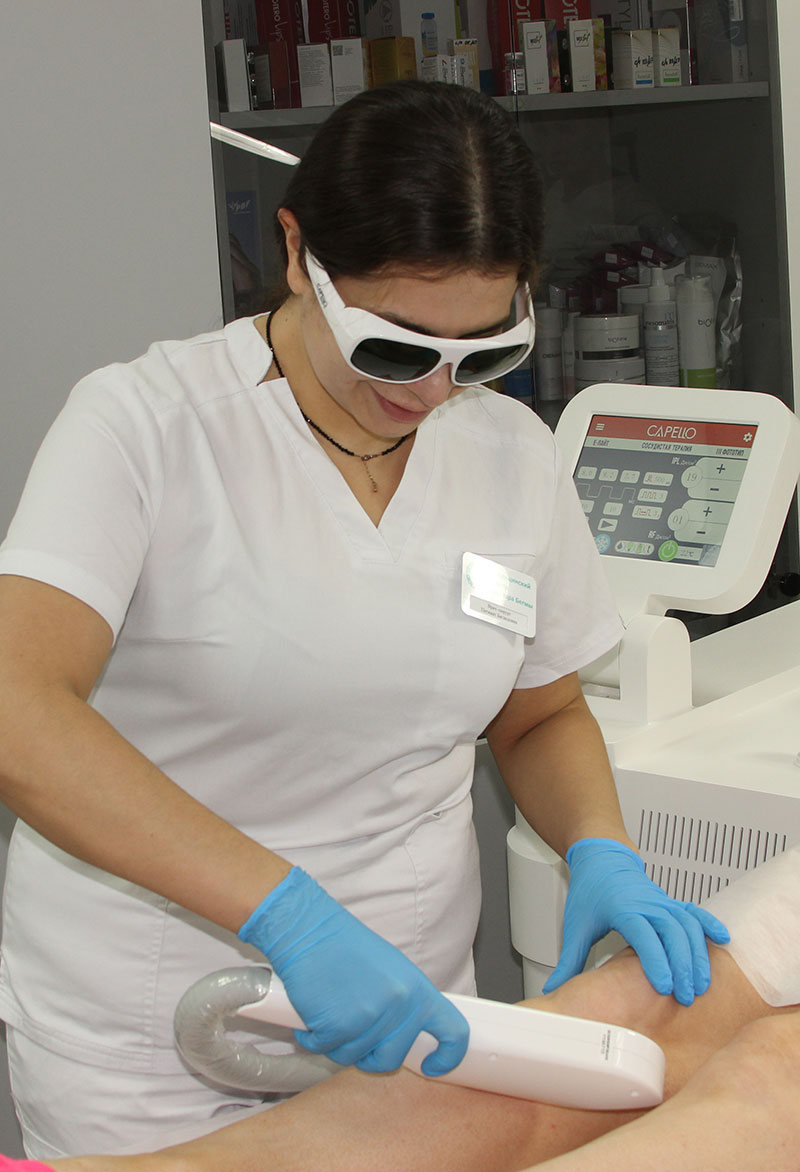 Удаление сосудистых звездочек на ногах лазером