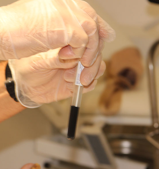 Прием врача-уролога в Москве