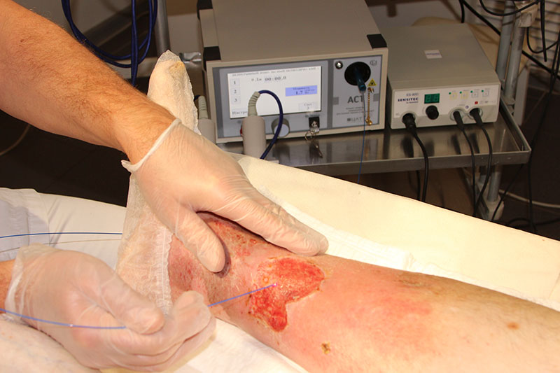 Противопоказания