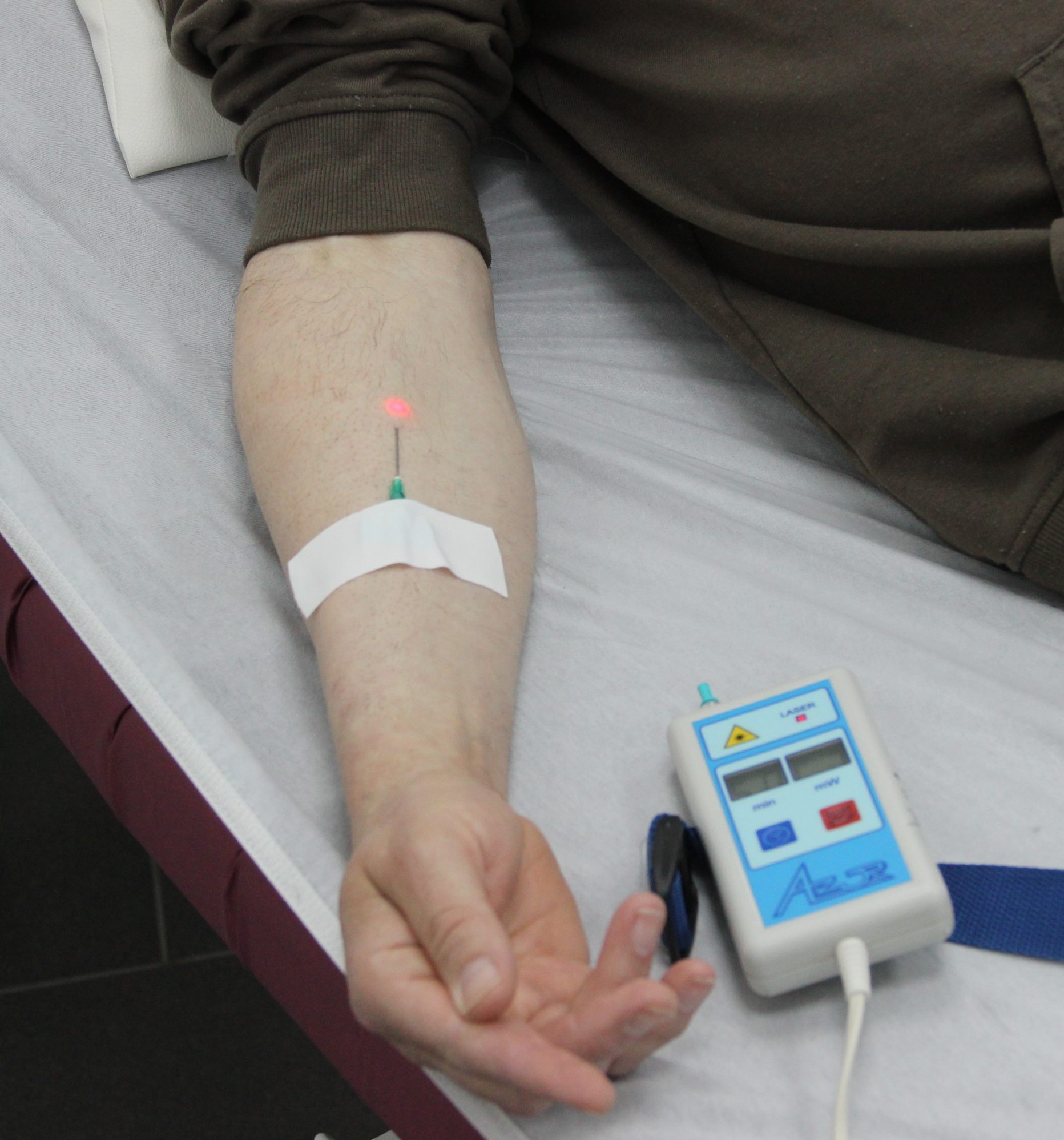 Внутривенное лазерное облучение крови (ВЛОК) Внутривенное лазерное облучение крови (ВЛОК)