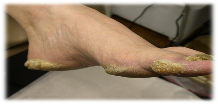 Подготовка к консультации врача-подолога