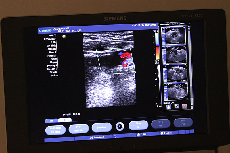 Виды ультразвуковой диагностики в МЦ Бегмы