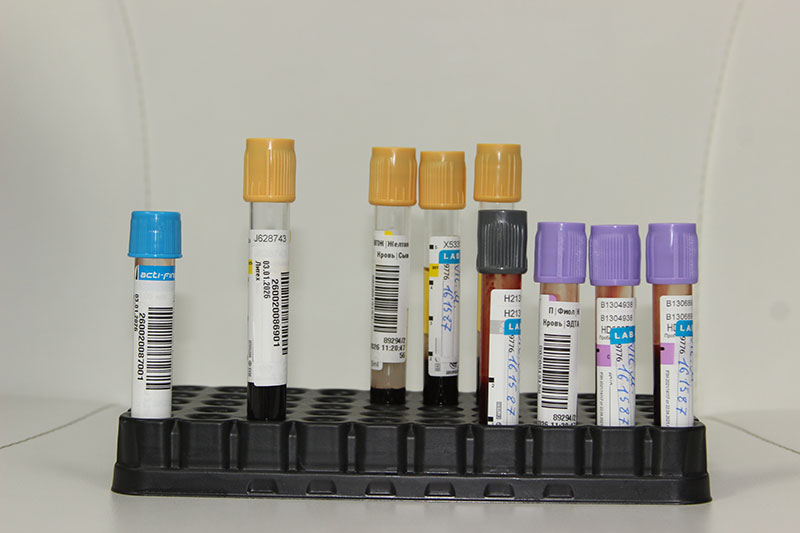 Как проходит лечение урологических заболеваний в МЦ Бегмы