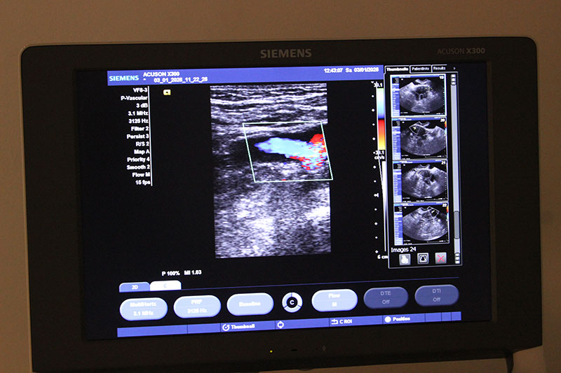 Показания к проведению УЗИ щитовидной железы