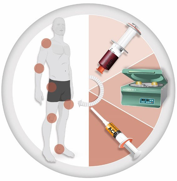 К какому врачу обратиться при болях в тазу