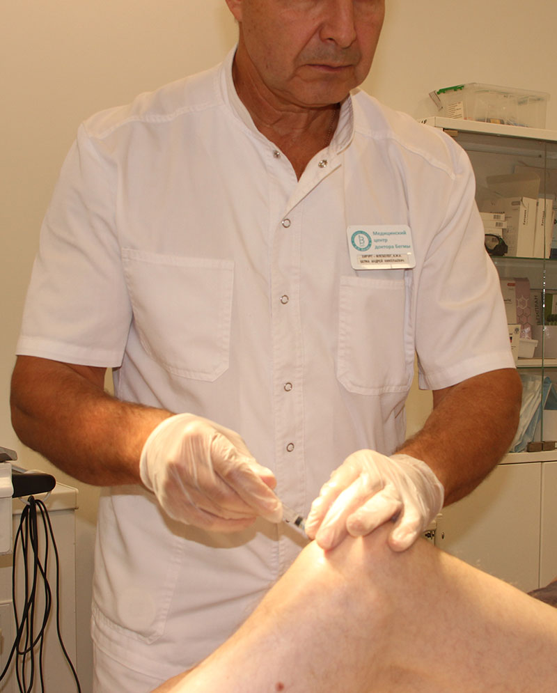 Лечение артроза коленного сустава