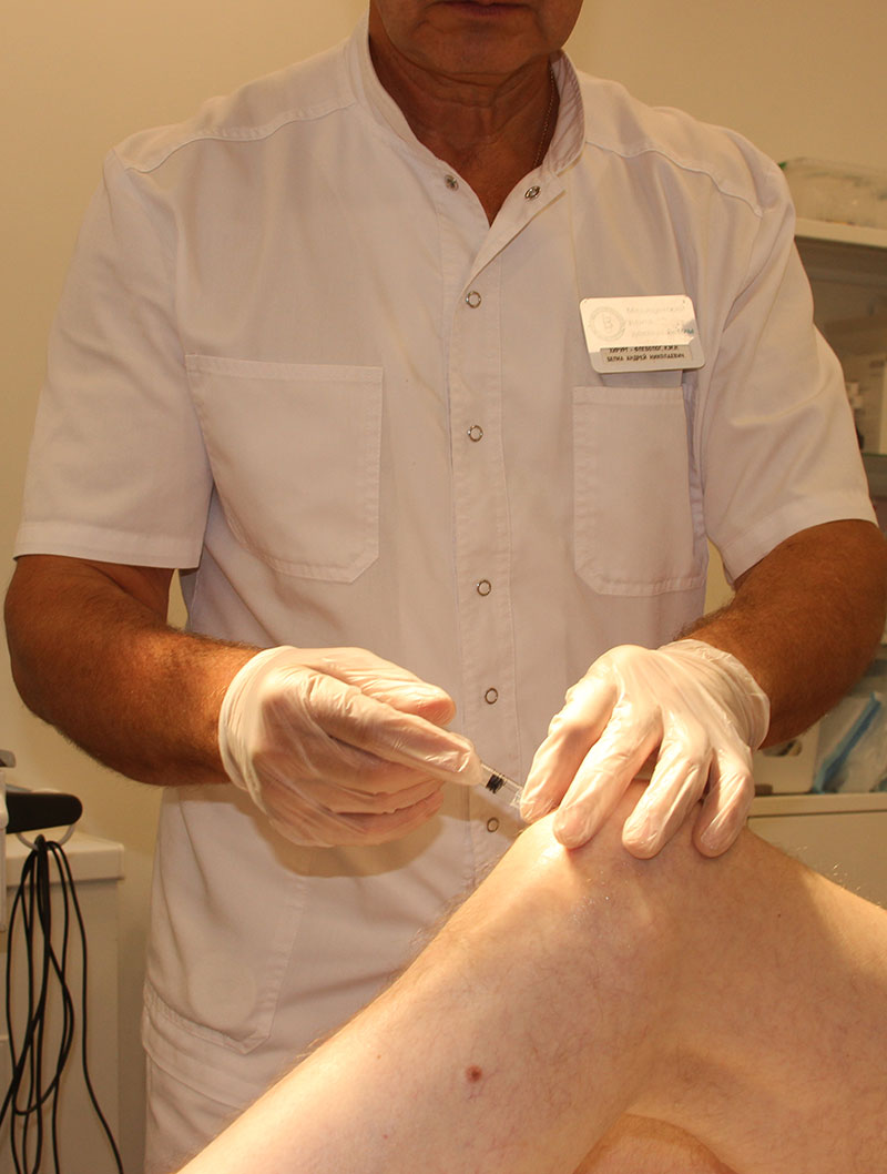 PRP-терапия коленного сустава