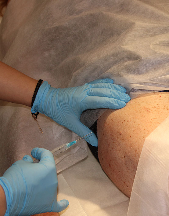 Уколы в тазобедренный сустав