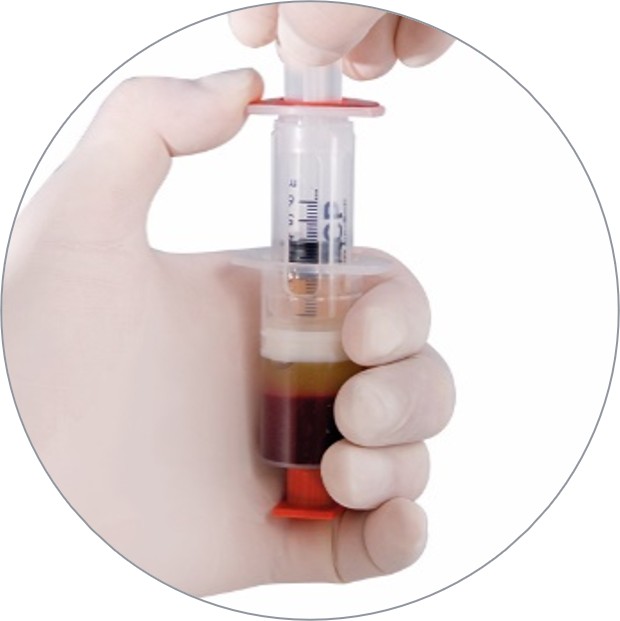 Показания к инъекциям плазмы в коленный сустав