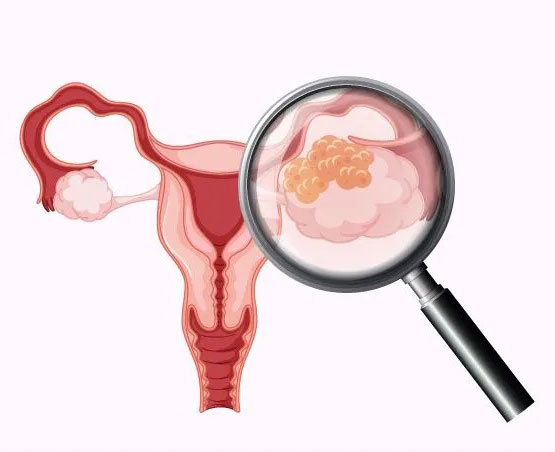 Методы диагностики в гинекологии