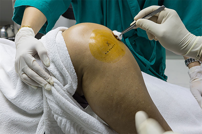 Показания к инъекциям при болях в коленях