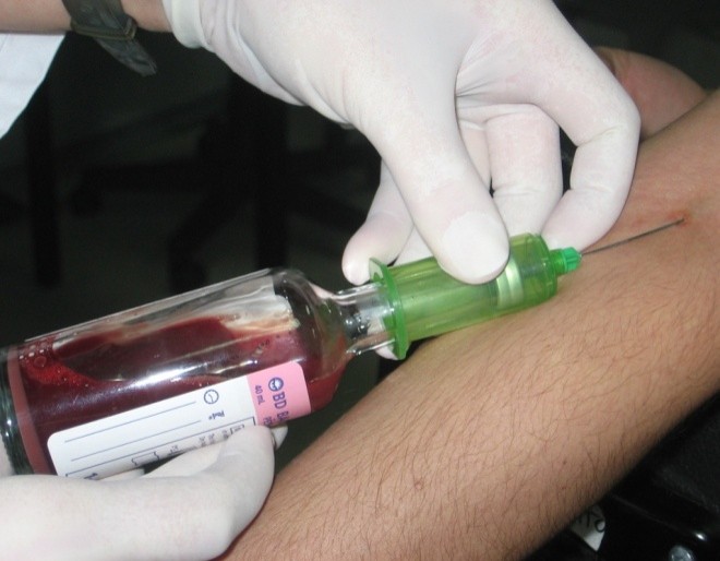 Преимущества плазмолифтинга для коленного сустава