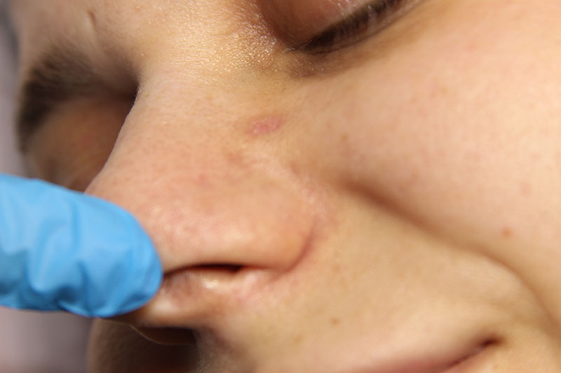 Противопоказания