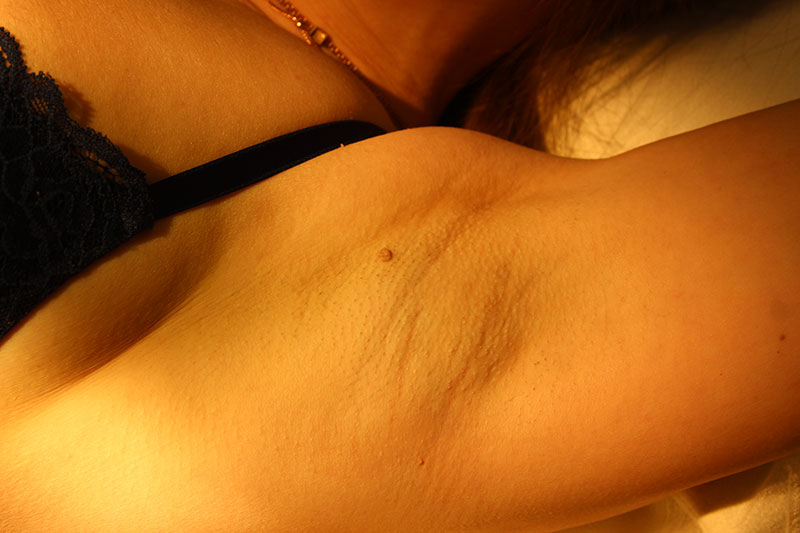 Противопоказания