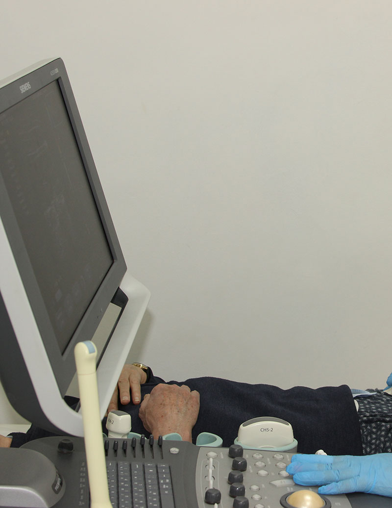 УЗИ предстательной железы