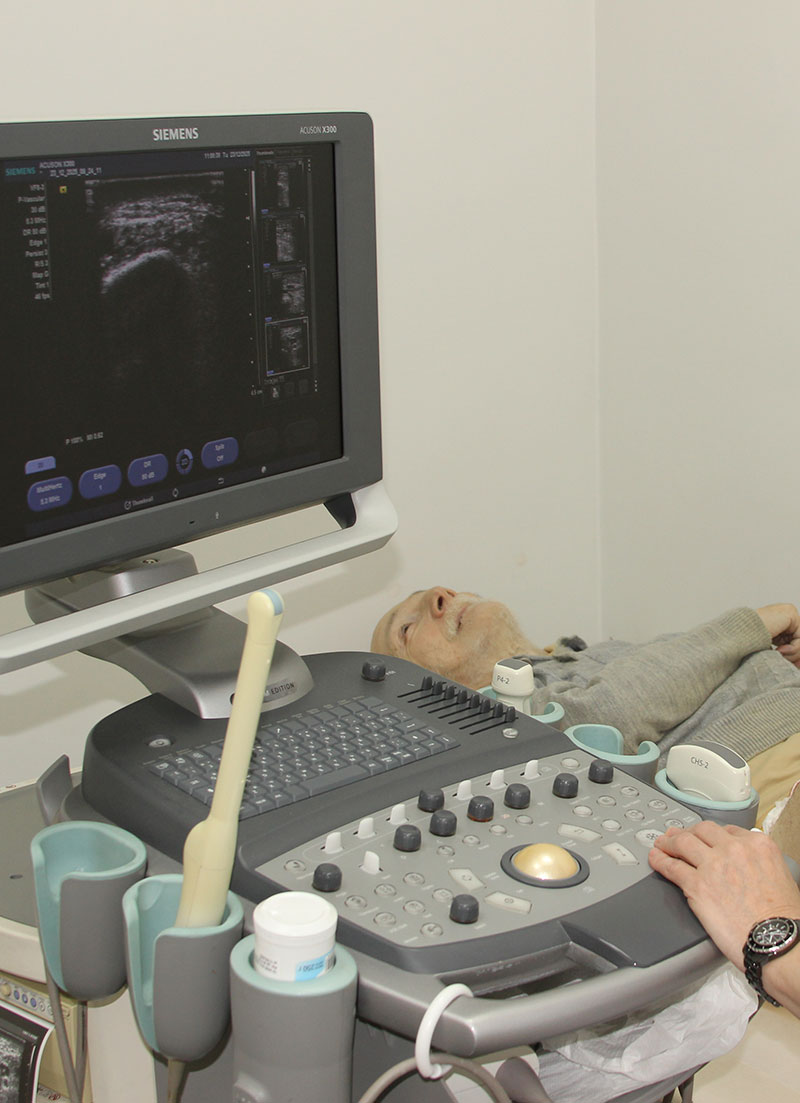 Трансабдоминальное УЗИ предстательной железы