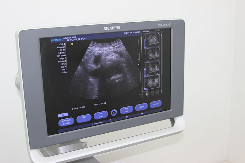 Что определяет УЗИ печени