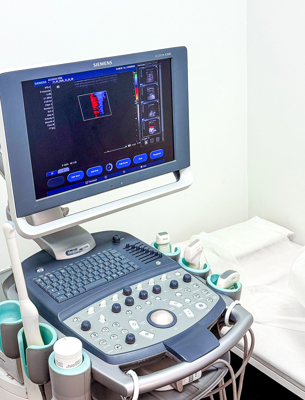 УЗИ желчного пузыря