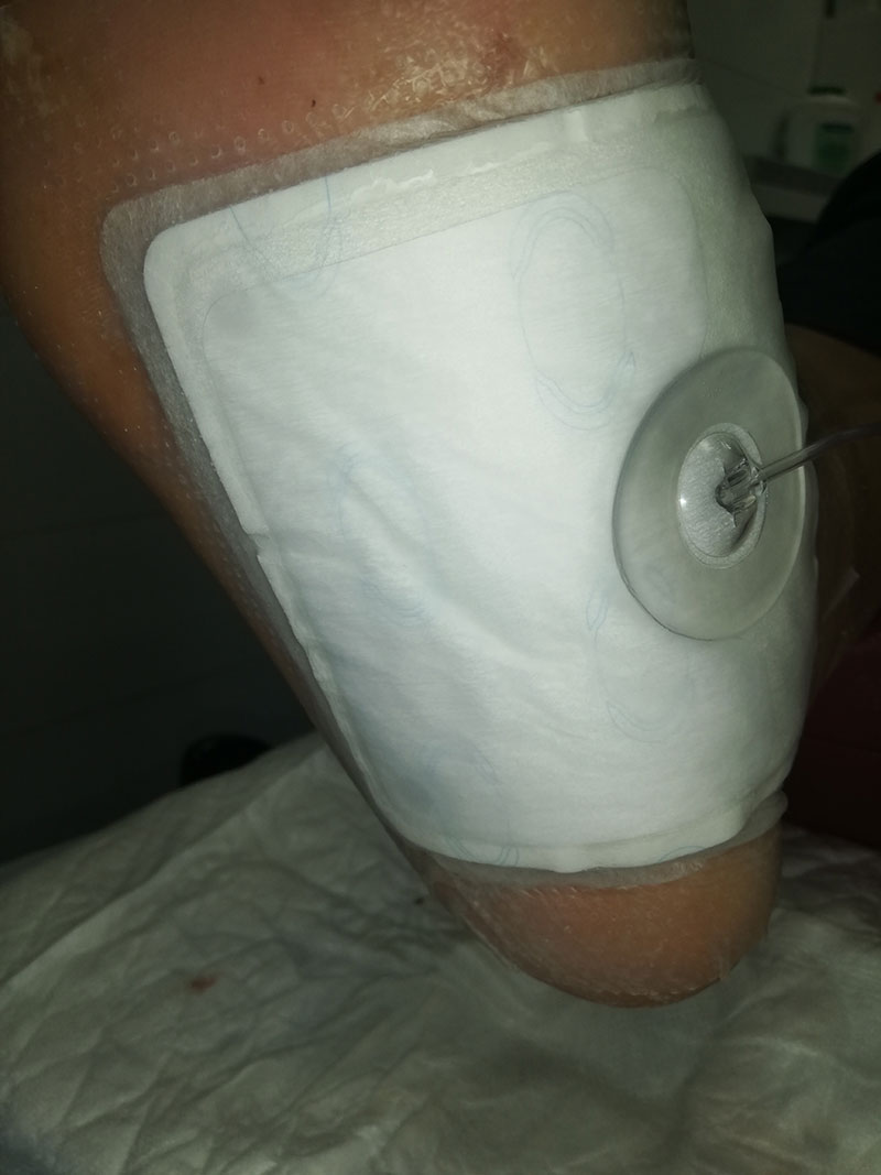 Какие процедуры проводятся на аппарате ВИТ Мобил