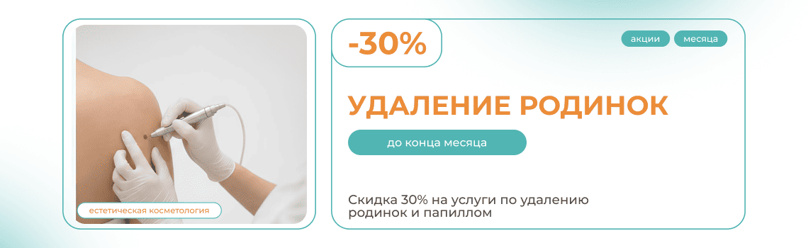 Удаление родинок и папиллом скидка 30%