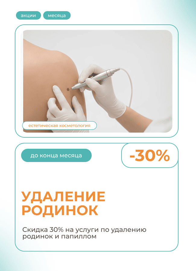 Удаление родинок и папиллом скидка 30%
