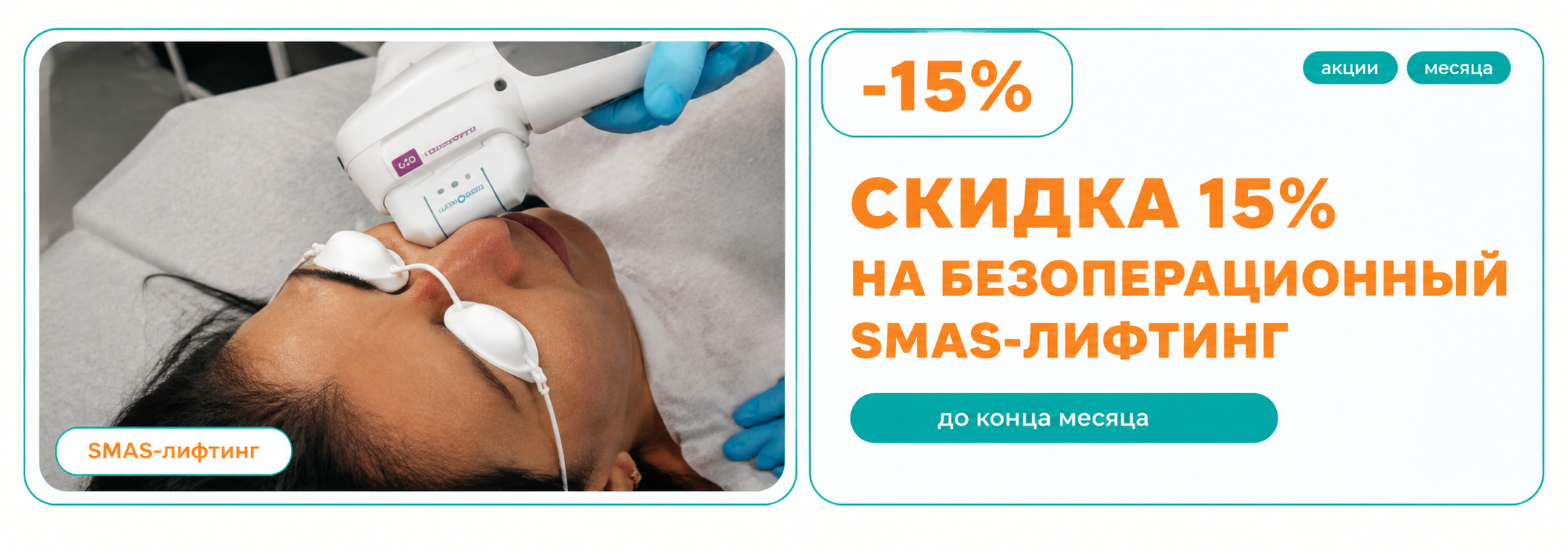 SMAS-лифтинг со скидкой 15%!