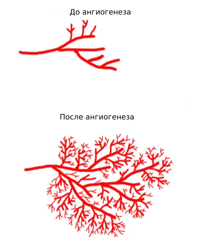 КАКИЕ СУЩЕСТВУЮТ СПОСОБЫ ЛЕЧЕНИЯ хронической ишемии нижних конечностей?