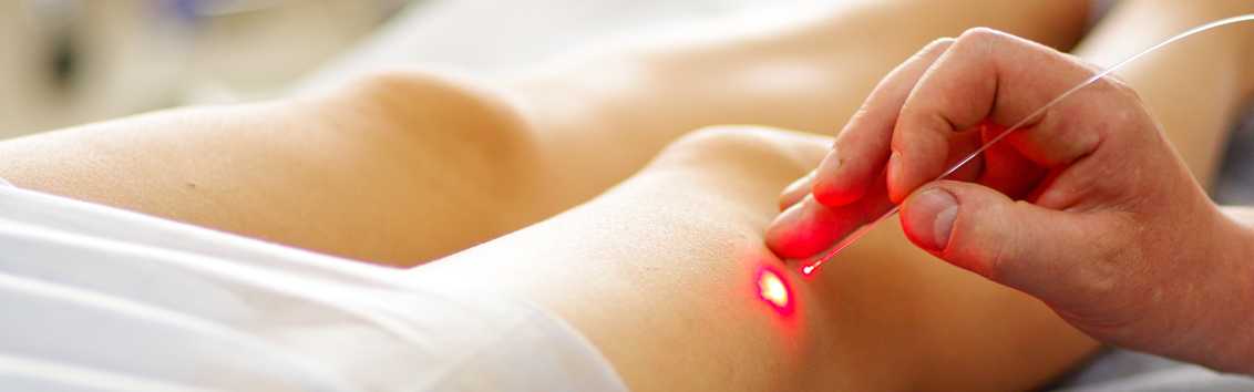 Лазерная операция при варикозе Лазерная операция при варикозе