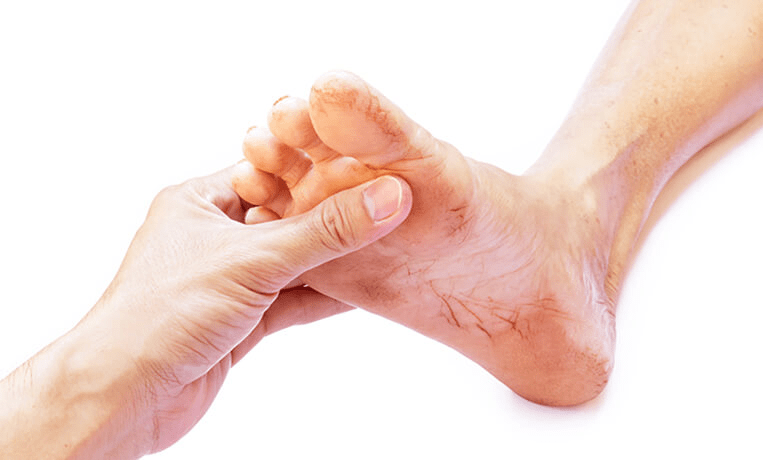 Диабетическая стопа